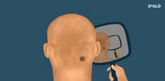 Melanoma Skin Cancer Risk Assessment A3-4 Melanoma skin cancer risk assessment