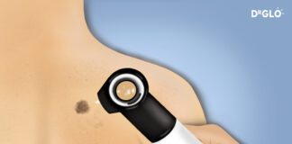 How Do You Get Tested for Melanoma