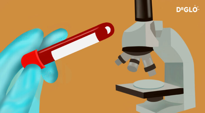 Would Melanoma Show in Blood Work? Would Melanoma Show in Blood Work?