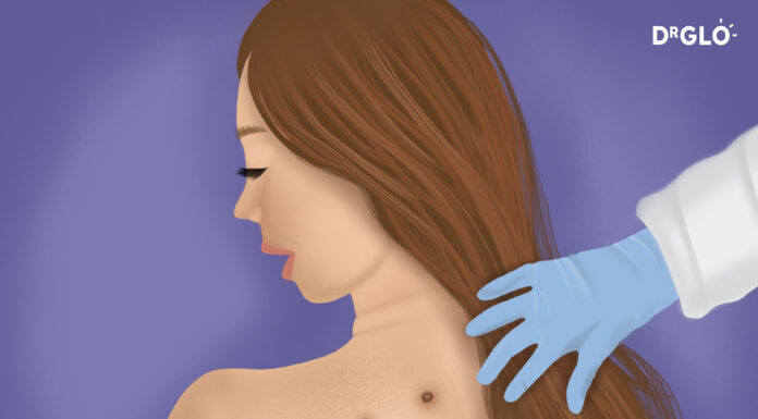 Can You Have Several Melanoma at the Same Time? Can You Have Several Melanoma at the Same Time?